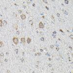 MTHFD1L Antibody in Immunohistochemistry (Paraffin) (IHC (P))