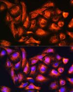 B9D1 Antibody in Immunocytochemistry (ICC/IF)