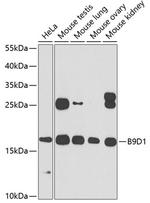 B9D1 Antibody in Western Blot (WB)