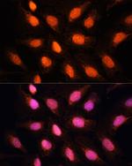 RAP1 Antibody in Immunocytochemistry (ICC/IF)