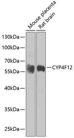 CYP4F12 Antibody in Western Blot (WB)