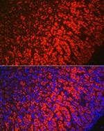 HSD3B1 Antibody in Immunohistochemistry (Paraffin) (IHC (P))