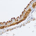 MYLK Antibody in Immunohistochemistry (Paraffin) (IHC (P))