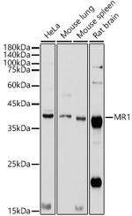 MR1 Antibody in Western Blot (WB)