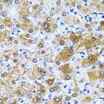 MBNL1 Antibody in Immunohistochemistry (Paraffin) (IHC (P))