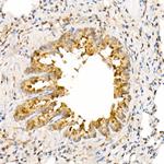 ANAPC2 Antibody in Immunohistochemistry (Paraffin) (IHC (P))