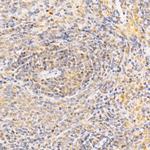 ANAPC2 Antibody in Immunohistochemistry (Paraffin) (IHC (P))