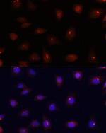 Centrin 3 Antibody in Immunocytochemistry (ICC/IF)