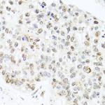 Centrin 3 Antibody in Immunohistochemistry (Paraffin) (IHC (P))