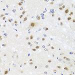 Centrin 3 Antibody in Immunohistochemistry (Paraffin) (IHC (P))