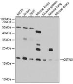 Centrin 3 Antibody in Western Blot (WB)