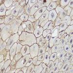 TRPC6 Antibody in Immunohistochemistry (Paraffin) (IHC (P))