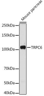 TRPC6 Antibody in Western Blot (WB)