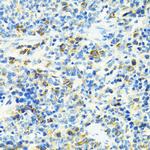 SLC25A11 Antibody in Immunohistochemistry (Paraffin) (IHC (P))