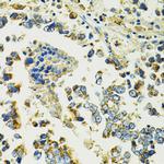 SLC25A11 Antibody in Immunohistochemistry (Paraffin) (IHC (P))