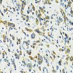 SLC25A11 Antibody in Immunohistochemistry (Paraffin) (IHC (P))