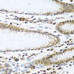 IFI44 Antibody in Immunohistochemistry (Paraffin) (IHC (P))