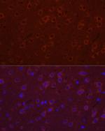 SYT11 Antibody in Immunocytochemistry (ICC/IF)