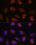 METTL7A Antibody in Immunocytochemistry (ICC/IF)