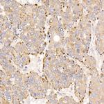 METTL7A Antibody in Immunohistochemistry (Paraffin) (IHC (P))