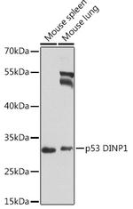 p53DINP1 Antibody in Western Blot (WB)