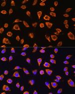 NOTCH4 Antibody in Immunocytochemistry (ICC/IF)