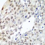 Securin Antibody in Immunohistochemistry (Paraffin) (IHC (P))