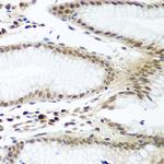 Securin Antibody in Immunohistochemistry (Paraffin) (IHC (P))