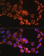 TRIM23 Antibody in Immunocytochemistry (ICC/IF)