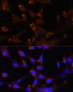 CAD Antibody in Immunocytochemistry (ICC/IF)