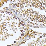 CAD Antibody in Immunohistochemistry (Paraffin) (IHC (P))