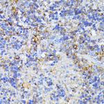 CAD Antibody in Immunohistochemistry (Paraffin) (IHC (P))