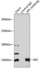 XPC Antibody in Immunoprecipitation (IP)