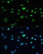 MDC1 Antibody in Immunocytochemistry (ICC/IF)