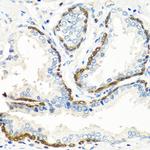 BMP5 Antibody in Immunohistochemistry (Paraffin) (IHC (P))