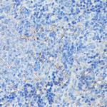 CD21 Antibody in Immunohistochemistry (Paraffin) (IHC (P))