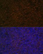 CD21 Antibody in Immunohistochemistry (Paraffin) (IHC (P))