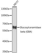 GBA Antibody in Western Blot (WB)