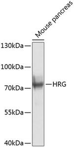 HRG Antibody in Western Blot (WB)