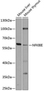 IkB epsilon Antibody in Western Blot (WB)