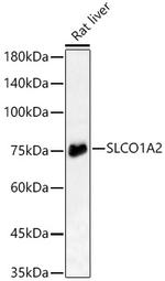 OATP1 Antibody in Western Blot (WB)