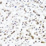 HIRA Antibody in Immunohistochemistry (Paraffin) (IHC (P))