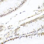 HIRA Antibody in Immunohistochemistry (Paraffin) (IHC (P))