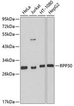 RPP30 Antibody in Western Blot (WB)