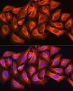 CKAP5 Antibody in Immunocytochemistry (ICC/IF)