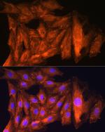 CKAP5 Antibody in Immunocytochemistry (ICC/IF)