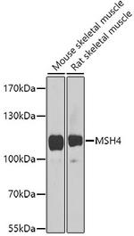 MSH4 Antibody in Western Blot (WB)