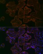 MYO5B Antibody in Immunohistochemistry (Paraffin) (IHC (P))