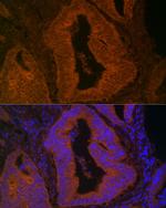 MYO5B Antibody in Immunohistochemistry (Paraffin) (IHC (P))