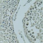 PRDM2 Antibody in Immunohistochemistry (Paraffin) (IHC (P))